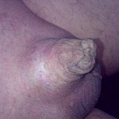 Bizarre useless miniature penis gallery.