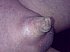 Bizarre useless miniature penis gallery.