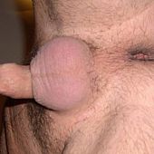 Fresh images of my miniature penis.